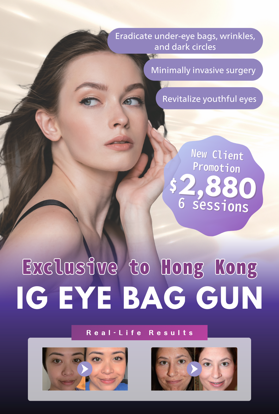 IG EYE BAG GUN